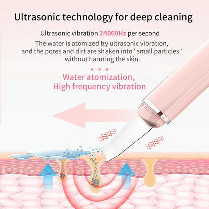 GlowChic™ Ultrasonic Skin Scrubber